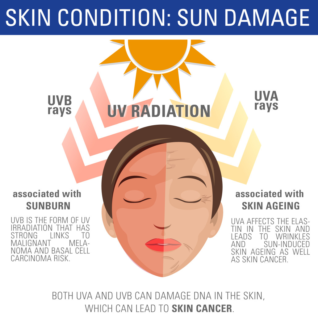 Skin Cancer, Prevention, UV Safety